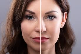 Rejuvenescimento Facial